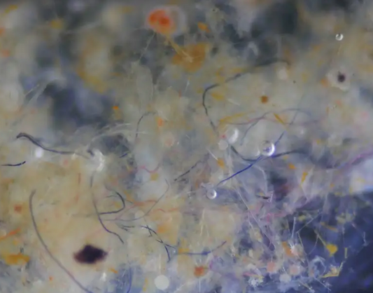 Health Risks Associated with Microplastics